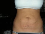 1 week before procedure